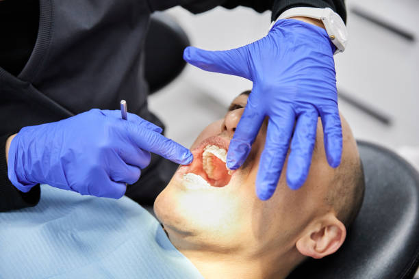Best Broken or Cracked Tooth Emergency Dentist in Auburn Hills, MI